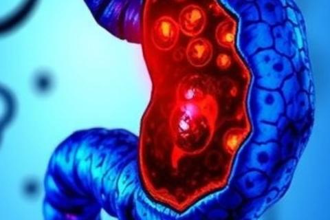 In a groundbreaking advance in the fight against pancreatic cancer, researchers at the University of Pennsylvania have unveiled a preclinical study demonstrating the efficacy of KRAS inhibitors to intercept pancreatic cancer development at its earliest stages.